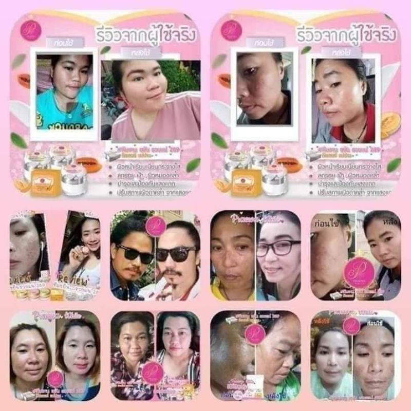 ครีมแพรวา-ไวท์-เลดี้-พิ้ง-สกิน-lady-pink-skin-praewa-white