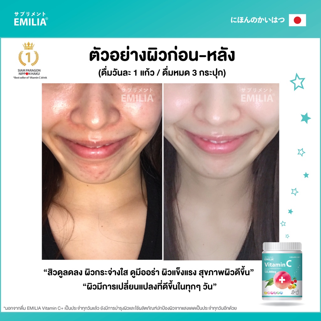 วิตามินซีสด-คอลลาเจน-เอมิเลีย-วิตซี-ผิวขาวใส-ออร่า-วิตซีถัง-ลดสิว-กลูต้า-ต้านหวัด-ภูมิแพ้-emilia-vitamin-c