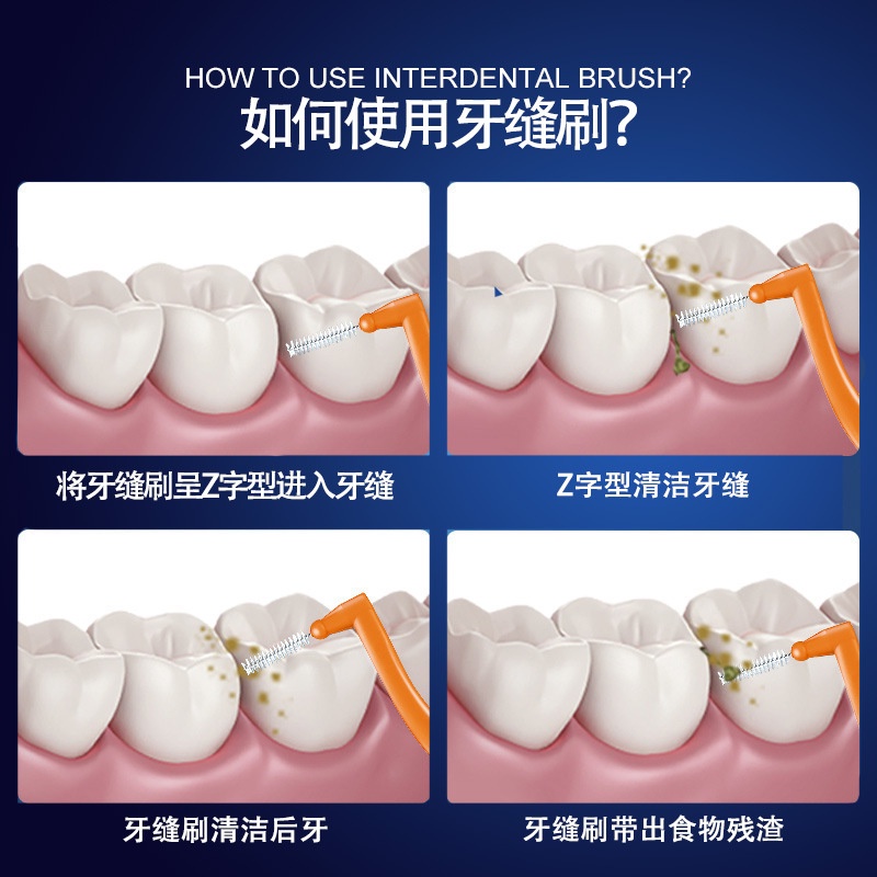 แปรงซอกฟันจัดฟัน-interdental-brush-5pcs-แปรงขัดฟันรูปตัว-l-ไหมขัดฟันจัดฟัน-sc9036