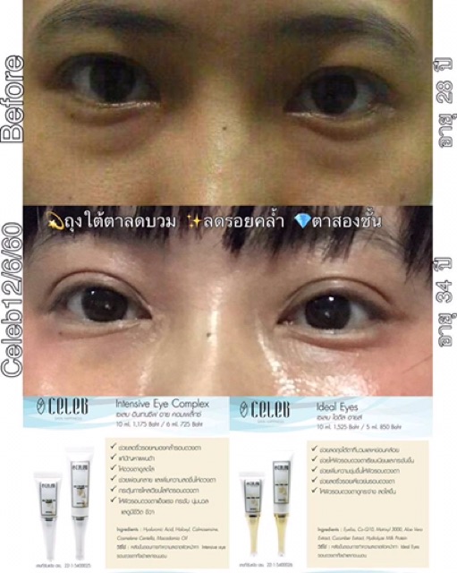 celeb-skin-ideal-eye-10g