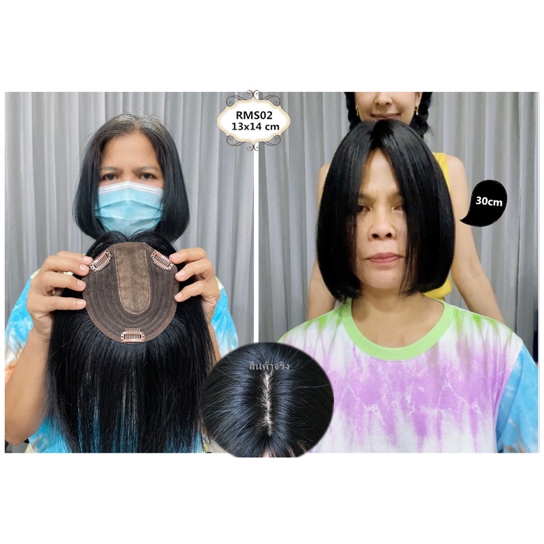 RMS02 เเผ่นปิดผมบาง,ปิดผมหงอก,ปิดศรีษะล้าน | Shopee Thailand