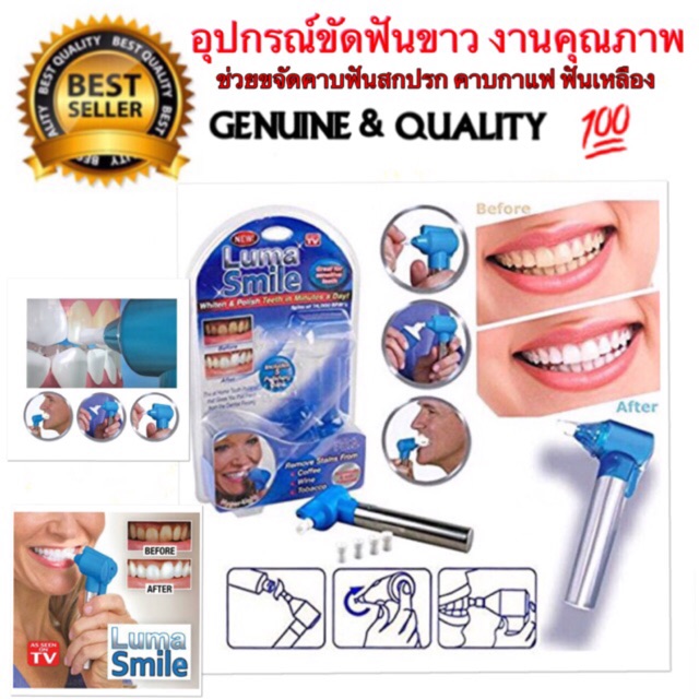 luma-smile-ของแท้-ที่นี้ที่เดียว-อุปกรณ์ขัดฟันขาว-ช่วยถนอมเนื้อฟันระหว่างขัด-ได้อย่างมีประสิทธิภาพ-มีไฟled-ในตัว