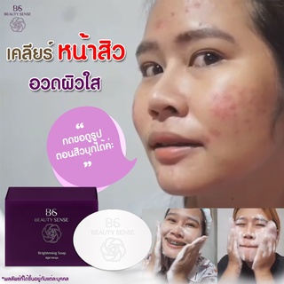 Beauty Sense Soap สบู่บิวตี้เซ้นส์ สบู่ขาวละมุน ปลอดภัย ไร้สารสเตียรอยด์ ลดสิวหนอง สิวอักเสบ สบู่ลดสิว ผิวติดสาร