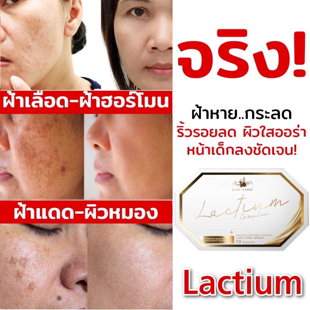 จำนวน-3-กล่อง-lactium-complex-วิตามินนมอูฐลดฝ้า-จุดด่างดำและ-สิว-ช่วยให้หน้ากระจ่างใส-นวัตกรรมอันดับ1-ของโลกจาก-lonza