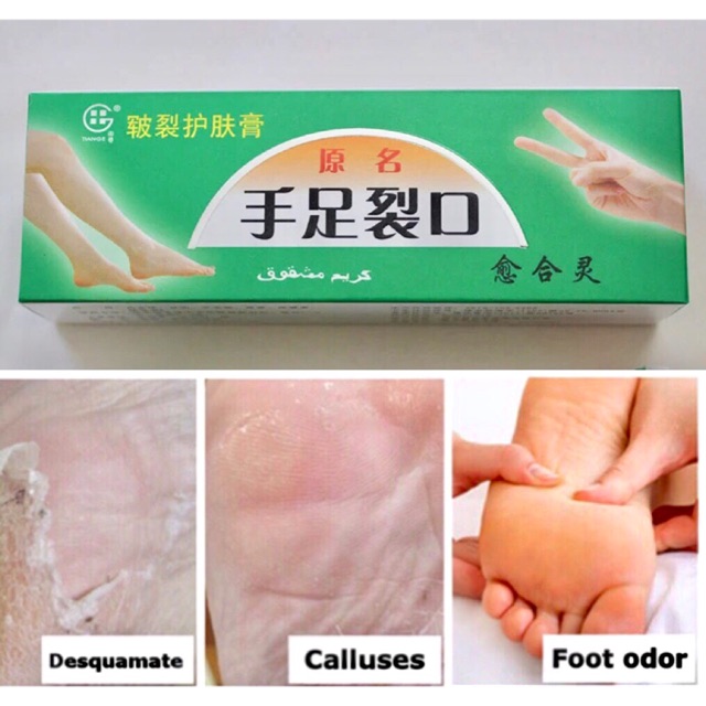 ครีมทาส้นเท้าแตก-powerful-hand-foot-crack-cream-heel-chapped-peeling-foot-and-hand-repair-anti-dry-crack-skin