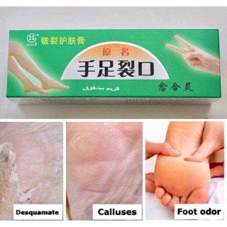 ครีมทาส้นเท้าแตก Powerful Hand Foot Crack Cream Heel Chapped Peeling Foot and hand Repair Anti Dry Crack skin