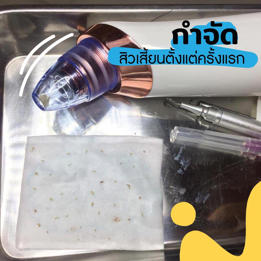 เครื่องดูดสิวเสี้ยน-by-charmer-clinic-ลดสิวเสี้ยนจมูก