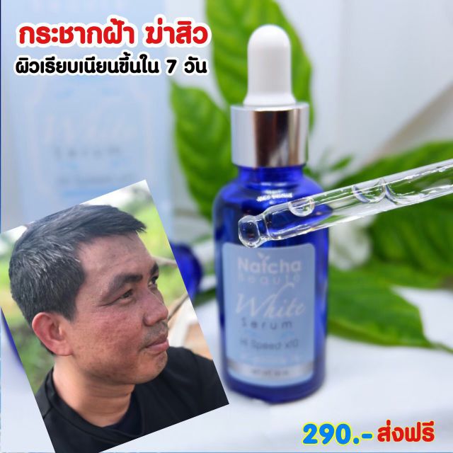 ของแท้100-natcha-white-serum-ณัชชา-ไวท์-เซรั่ม-สูตรใหม่ล่าสุดเข้มข้นกว่าเดิม-20เท่า-เพื่อผิวขาวกระจ่างใส