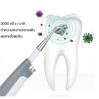 bys-เครื่องขูดหินปูน-sonic-pic-กำจัดหินปูน-ทำความสะอาดซอกฟัน-ขจัดคราบ-เครื่องขูดหินปูนไฟฟ้า