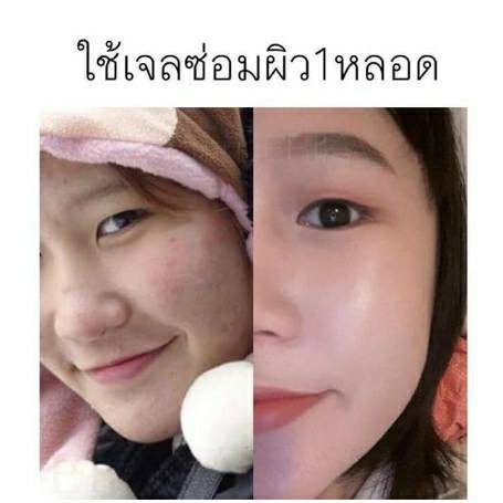 เจลซ่อมผิว-skinrepair-gel-erika-เน้นลดสิว-ลดรอย-หน้ากระจ่างใสขึ้น