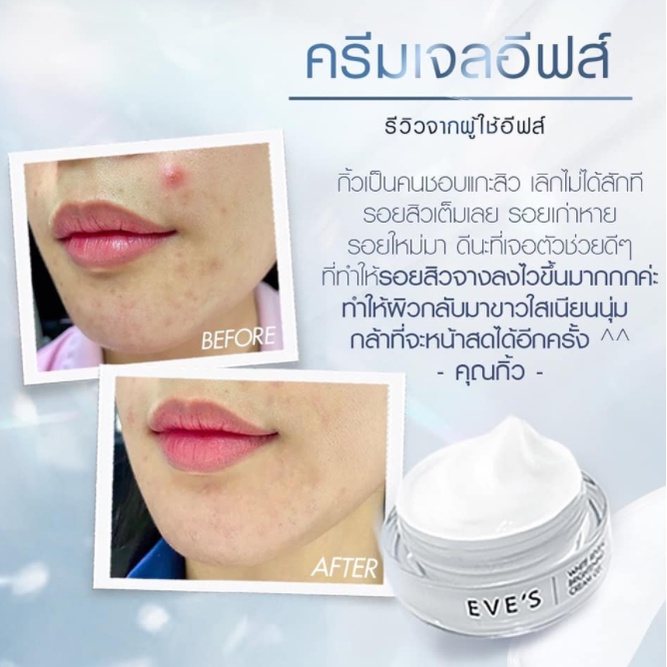 โปรส่งท้ายปี-ครีมเจลอีฟส์-ของแท้100-eves-cream-gel