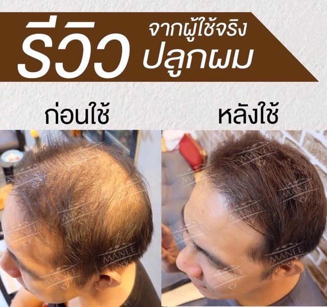 แชมพูสมุนไพรมณี-1-ขวด-ขนาด-200ml