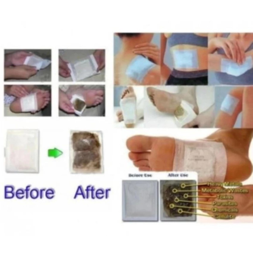 แผ่นแปะเท้าดูดสารพิษ-แผ่นดูดสารพิษจากเท้าkinoki-detox-foot-pad-2-กล่อง