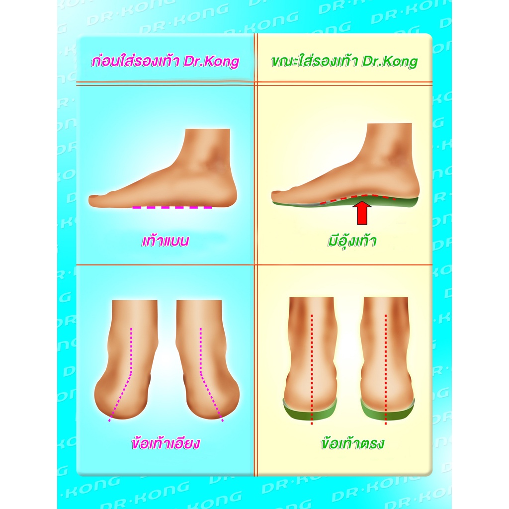 dr-kong-prohealthy-comfort-insole-แผ่นรองเท้าเสริมอุ้งเท้า