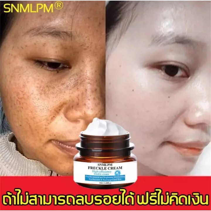 snmlpmครีมทาฝ้ากระคราบจุดด่างดำผิวไหม้-เผยผิวที่ผุดผ่อง-ครีมทาฝ้าครีมรักษาฝ้าครีมทาหน้า-1093