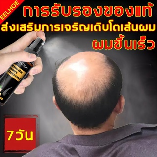 🔥หมดปัญหาผมร่วง🔥 น้ำยาปลูกผม 30ML เร่งการงอกใหม่ ป้องกันไม่ให้ขิงหลุด รากผมแข็งแรง(น้ำยาปลูกผมผู้ชาย เซรั่มปลูกผม)