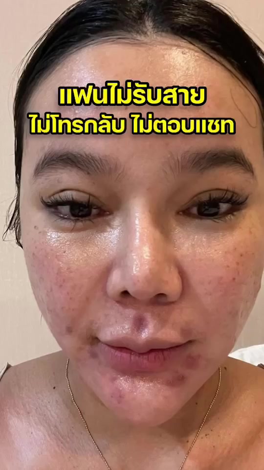 1แถม1-ครีมส้มสดหน้าใส-โซยุ้ย-soyou-เห็นผลการเปลี่ยนแปลงภายใน-7-วัน-ลดสิว-ฝ้ากระ-จุดด่างดำ-รอยดำ-ลดรอยสิว-ลดสิวอุดตัน