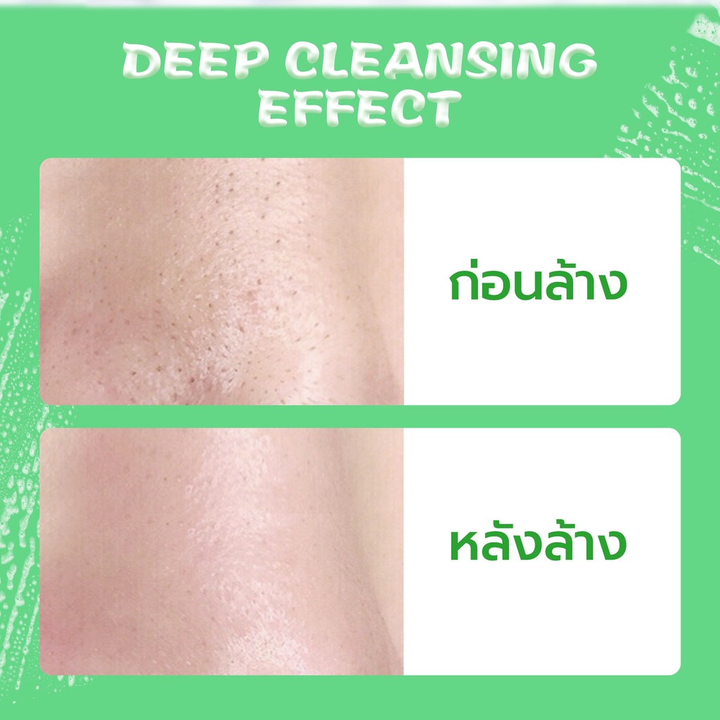 ภาพสินค้าYOU Hy Amino AC-Ttack Anti-Acne Facial Wash จากร้าน y.o.u_thailand_official บน Shopee ภาพที่ 7