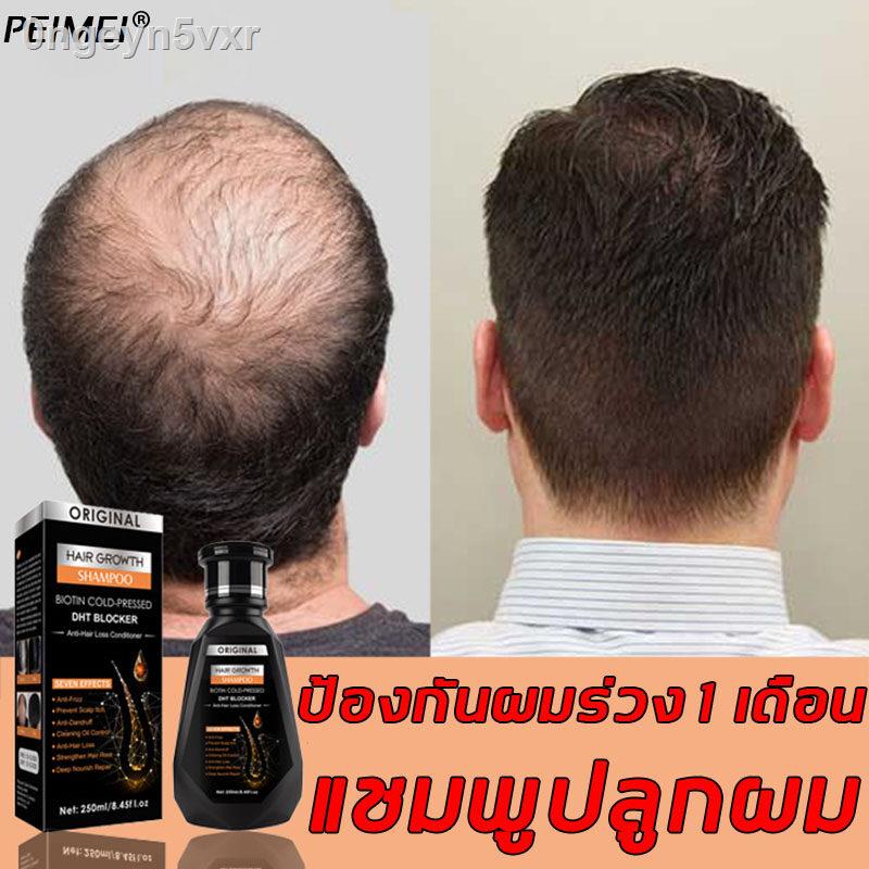 peimei-แชมพูสมุนไพรขิงบำรุงผม-250ml-สูตรน้ำขิง-ปลูกผมอย่างอ่อนโยน-บำรุงรากผม-แชมพูขิงเพียว-แชมพูเร่งผมยาว-แชมพูแก้ผมร่วง