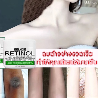 EELHOE ไวท์เทนนิ่งครีม ครีมทาผิวขาว 30g ครีมเข่าขาว ครีมขาขาว ครีมทาก้นขาว ครีมรักแร้ขาว ครีมทาริมฝีปาก รักแร้ ขาหนีบ กำจัดเมลานิน（ครีมทารักแร้ดำ ครีมขาหนีบดำ โลชั่นผิวขาว ครีมทาขาหนีบดำ）Whitening Cream