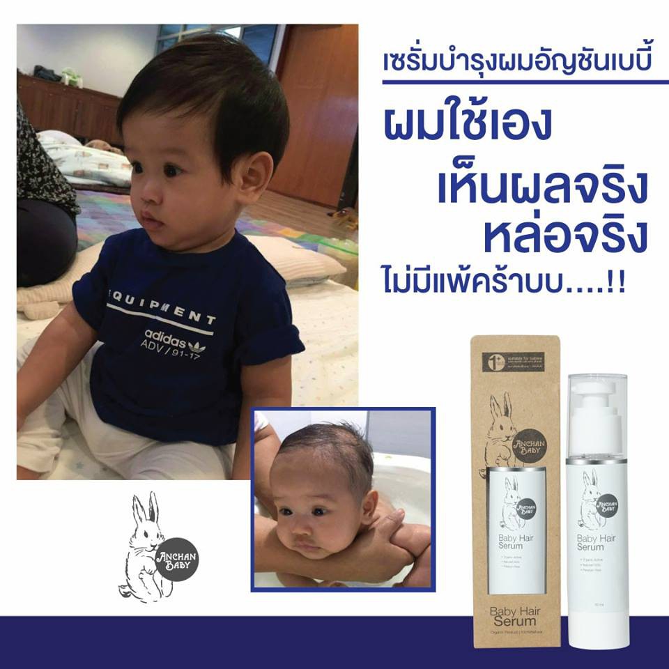 anchanbaby-เซรั่มอัญชันบำรุงผมเด็ก-x2-ขวด-อัญชันเบบี้-hair-serum