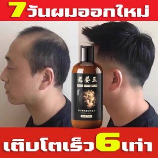 【ผมยาวได้เร็วมาก】แชมพูแก้ผมร่วง แชมพูขิง 300ML แชมพูขิง แชมพูขิงเพียว สระผมแก้ร่วง แก้ไขผมร่วง แก้อาการคัน กำจัดรังแค