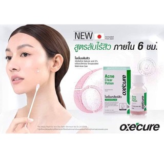 Acne​ clear​ potion​ oxecure แต้มสิวยุบใน​ 6​ ชม.