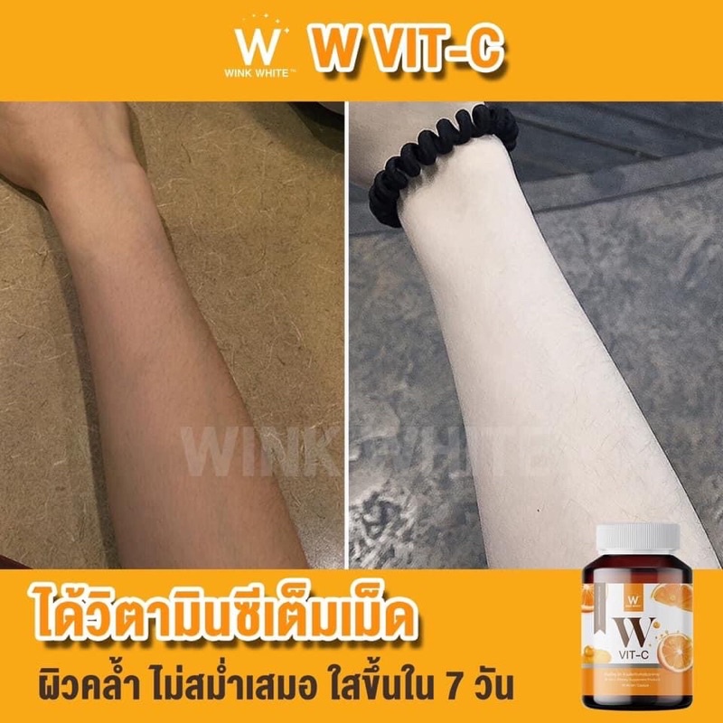 วิตามินซี-แบรนด์วิ้งไวท์-โปร-5-แถม-6-ส่งฟรี