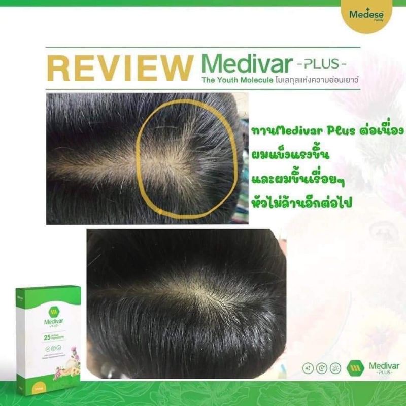 medivarplus-เรื่องผิวไม่ใช่งานมโน