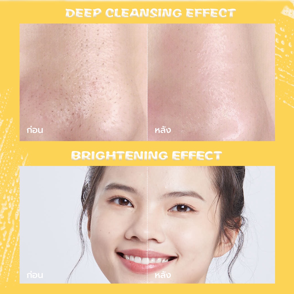 ภาพสินค้าYOU Hy Amino Glo-Win Brightening Facial Wash จากร้าน y.o.u_thailand_official บน Shopee ภาพที่ 7