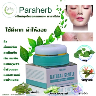 สิว ตุ่มคัน ผื่นคัน PARAHERB พาราเฮิร์บ สารสกัดทองพันชั่ง  สารสกัดพญายอ  สารสกัด ว่านรางจืด  สารสกัดว่านหางจระเข้  สารสกัดพลู คัน รอยแดง สิว