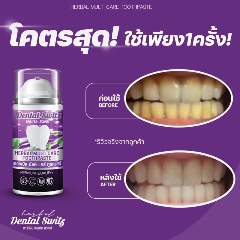 เจลฟอกฟันขาวdental-switz-เจลฟอกฟัน-ฟันขาว-ยาสีฟันขาว-1แถม-1