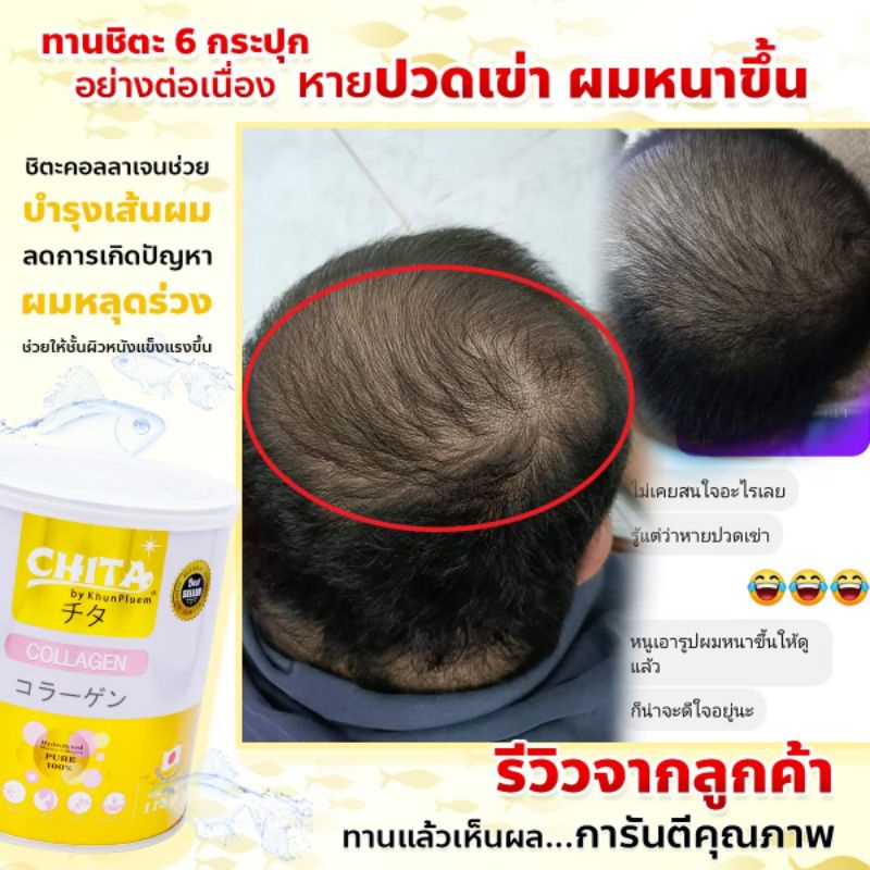 ชิตะ-115กรัม-ของแท้ส่งตรงจากบริษัท-มีราคาส่ง