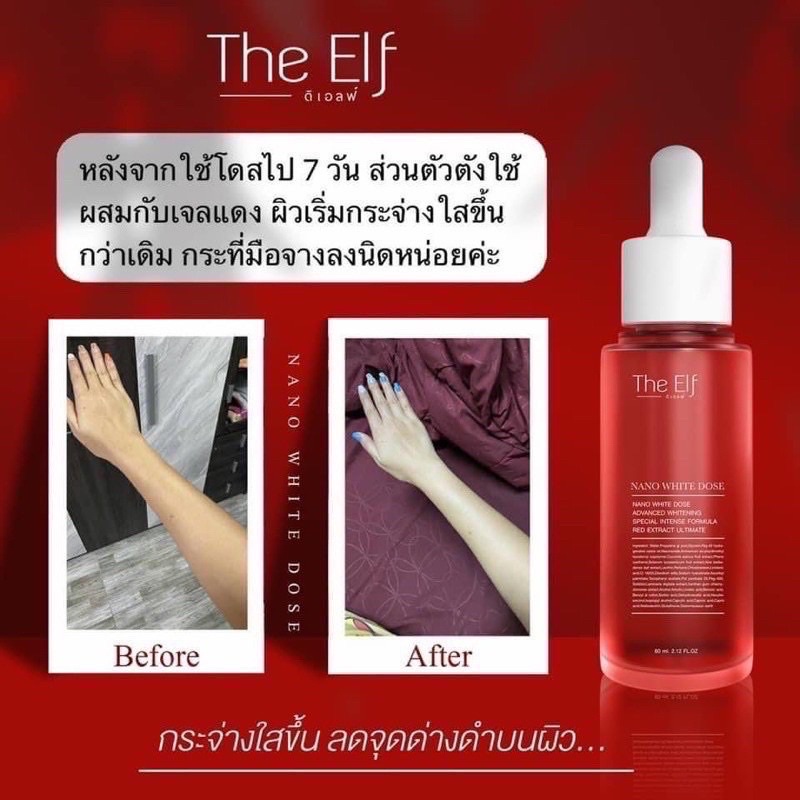 ตอกย้ำคุณภาพ-ใช้แล้วเห็นผล-98-ของลูกค้าที่ใช้-กลับมาซื้อซ้ำ-ใช้ต่อเนื่องผิวขาวใสขึ้นกว่าที่เคย-ขาวยาก-ใช้อะไร