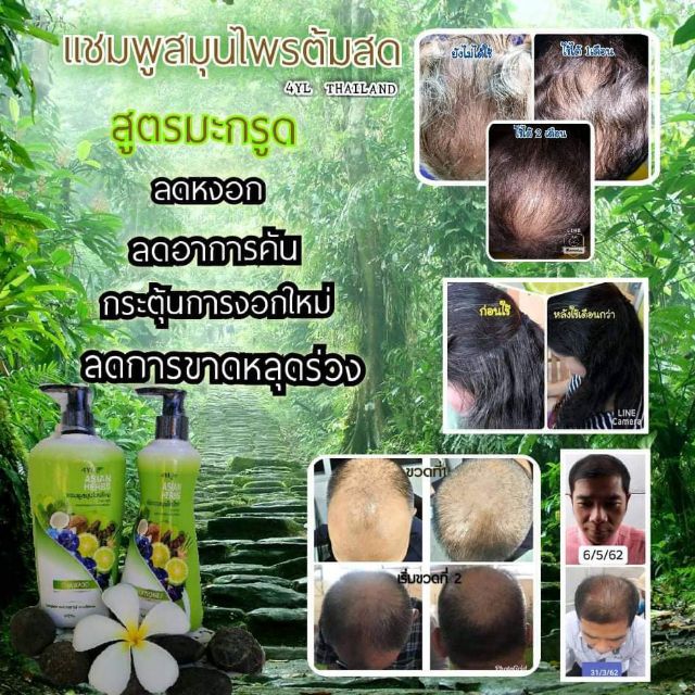 แชมพูลดอาการผมร่วง-ผมบาง-เชื้อราบนหนังศรีษะ