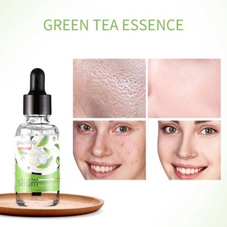 สินค้า Green tea serum  กรีนที เซรั่ม (35ml) สูตรใหม่ เซรั่ม หน้าใส ลดสิว NO.100