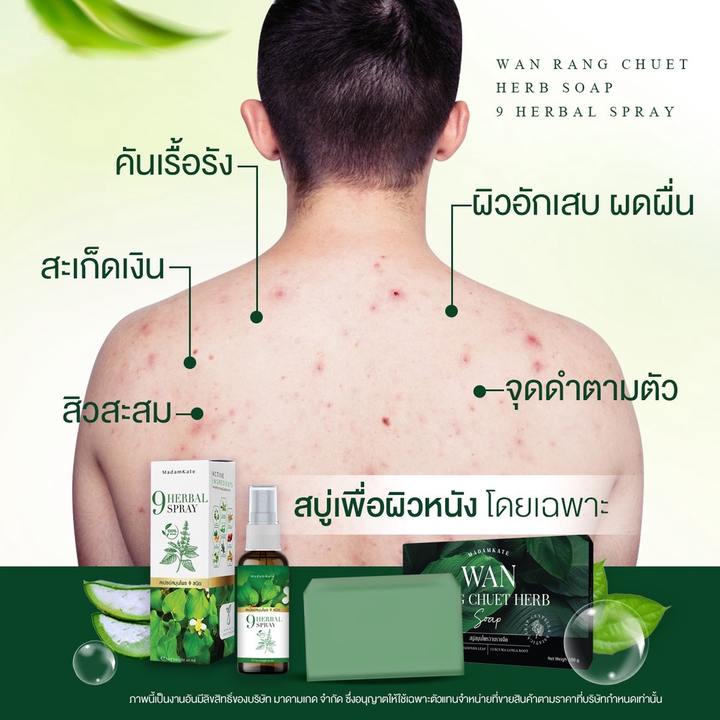 3ชิ้นส่งฟรี-รักษาสิวที่ตัว-สิวที่หลัง-ผดผื่นคัน-สังคัง-กลากเกลื้อน-สะเก็ดเงิน-เชื้อรา-สบู่ว่านรางจืด-สเปรย์