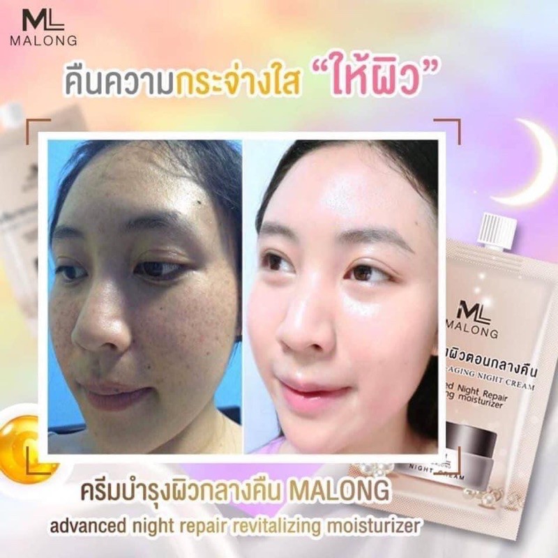 ครีมมาลอง-ครีมแก้ฝ้า-หน้าใส