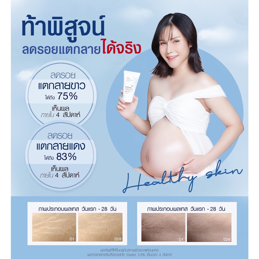 eves-บอดี้ออยล์เจลอีฟส์-stretch-mark-body-oil-gel-ผิวนุ่มชุ่มชื้น-ลดรอยแตกลาย-ป้องกันแตกลาย-ลดรอยแผลเป็นจุดด่างดำ