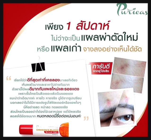 puricas-dragon-blood-scar-gel-8g-เจลลดรอยแผลเป็น-รอยสิว-รอยแดง-รอยดำ-ช่วยฟื้นฟูผิว-อ่อนโยนต่อผิวแพ้ง่าย-รอยแผลดูจางลง