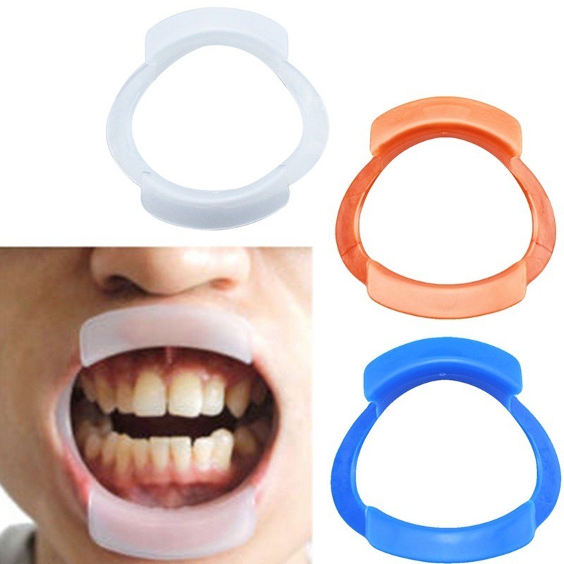 อุปกรณ์ทันตกรรม-ที่เปิดปากเพื่อฟอกสีฟัน