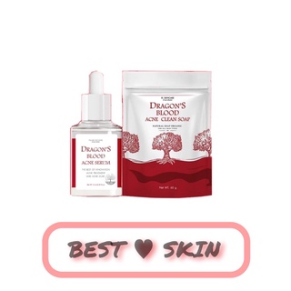 Dragons Blood Acne เซรั่มเลือดมังกร คู่หูลดสิว