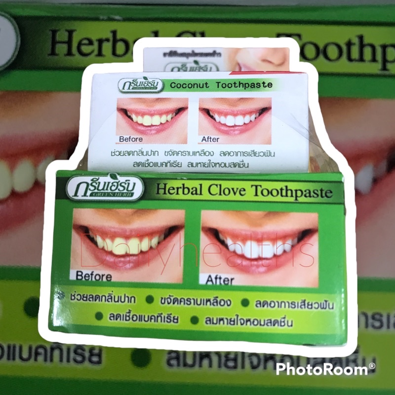 ของแท้-gt-gt-กรีนเฮิร์บ-ยาสีฟันสมุนไพร-สูตรกานพลู-ขนาด-25-กรัม-แถมฟรี-ยาสีฟันสมุนไพรสูตรมะพร้าว-ขนาด-10-กรัม