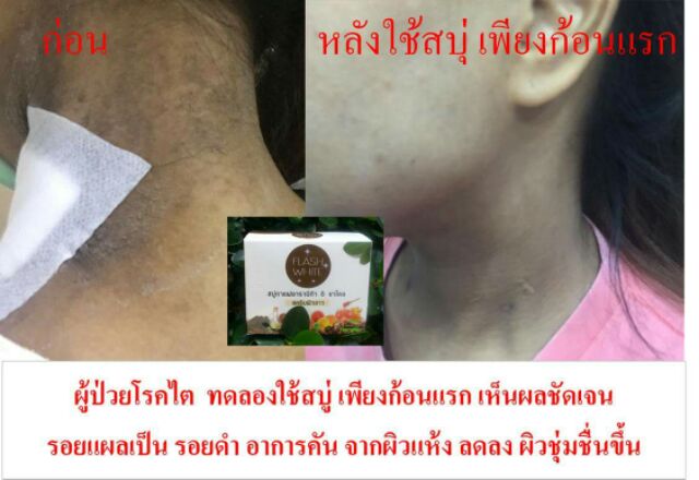 flash-white-สบู่กาแฟสครับผิวขาว-มาร์คขัดในขั้นตอนเดียว