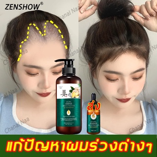 สินค้า 👀 ซื้อ 1 แถม 1 🔥แชมพูแก้ผมร่วง ZHENSHOW แชมพูขิง 500MLแชมพูสมุนไพร แชมพูเร่งผมยาว แชมพูชายหญิง เซรั่มปลูกผม