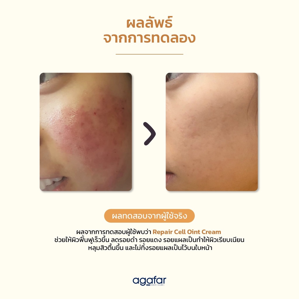 ผลิตภัณฑ์ลดรอยดำ-รอยแดง-รอยแผลเป็น-หลุมสิว-agafar-repair-cell-oint-cream-15-ml-สกินแคร์นำเข้าจากเกาหลีแท้100