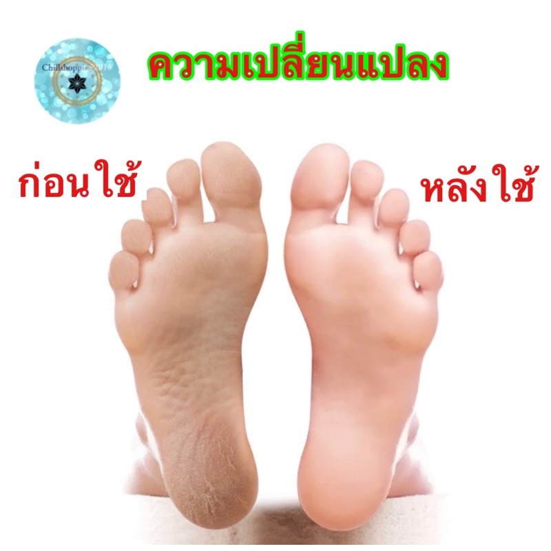 chsn10-จิ๋ว-แปรงขัดส้นเท้า-จิ้ว-foot-file-pedicure-ขัดเท้าแตก-แปรงขัดเท้า