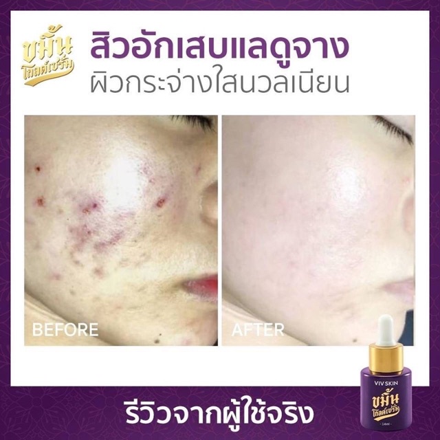 ขมิ้นโกลด์เซรั่ม-by-viv-skin