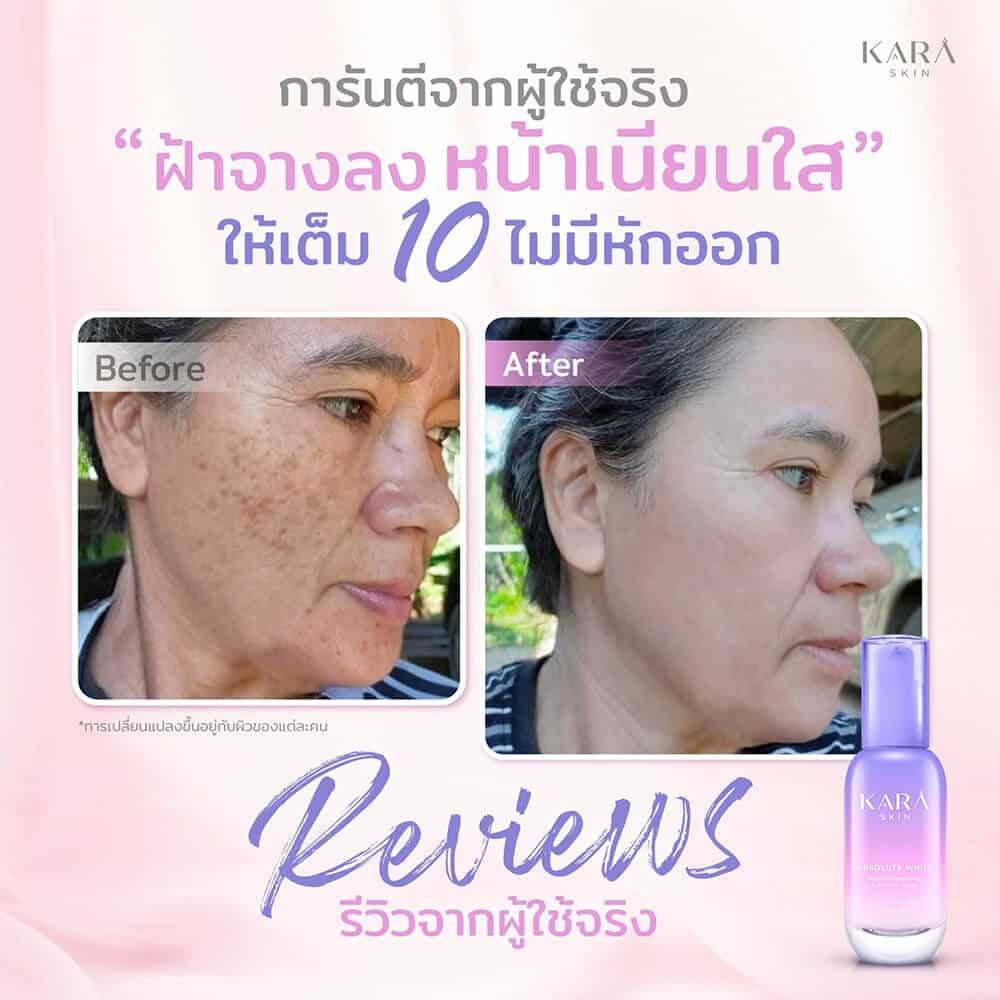 karaskin-คาร่าสกิน-ซื้อ1แถม1-เดือนนี้เท่านั้น-สูตรฝรั่งเศส-ของแท้จากบริษัททางการ