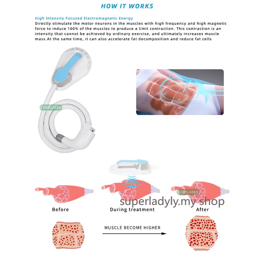 loses-weight-quickly-emslim-machine-electromagnetic-muscle-stimulation-machine-ems-training-machine-odrb